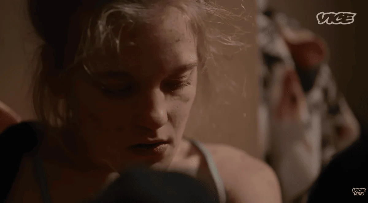 Close-up of a young woman with blonde hair, scars and lesions on her face, and a stressed, focused expression in a dimly lit room, with a Vice News logo in the upper right.